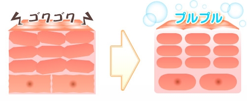 新発想のニキビケアはリプロスキンで決まり!